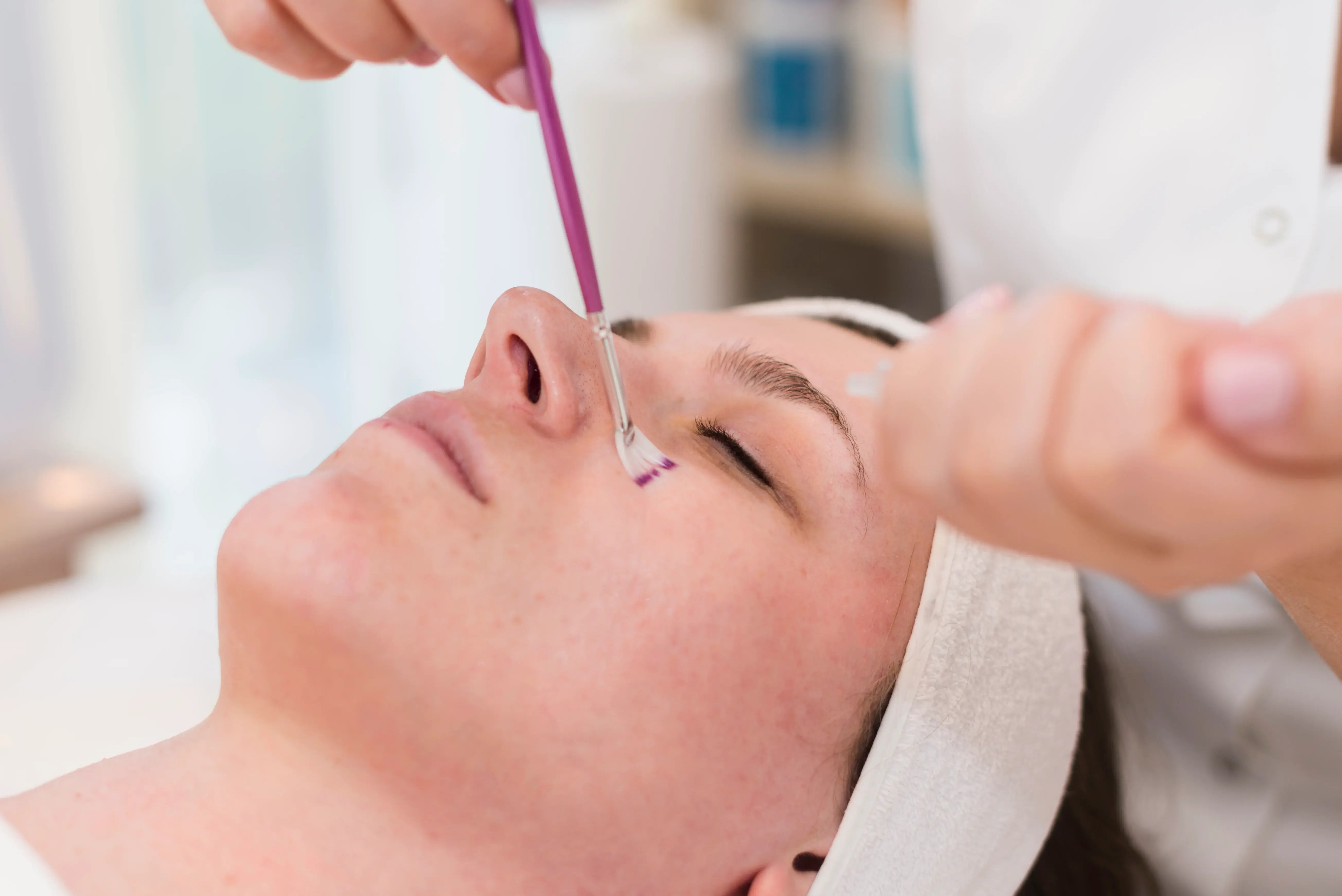 Acne scar and laser treatment for all skin types