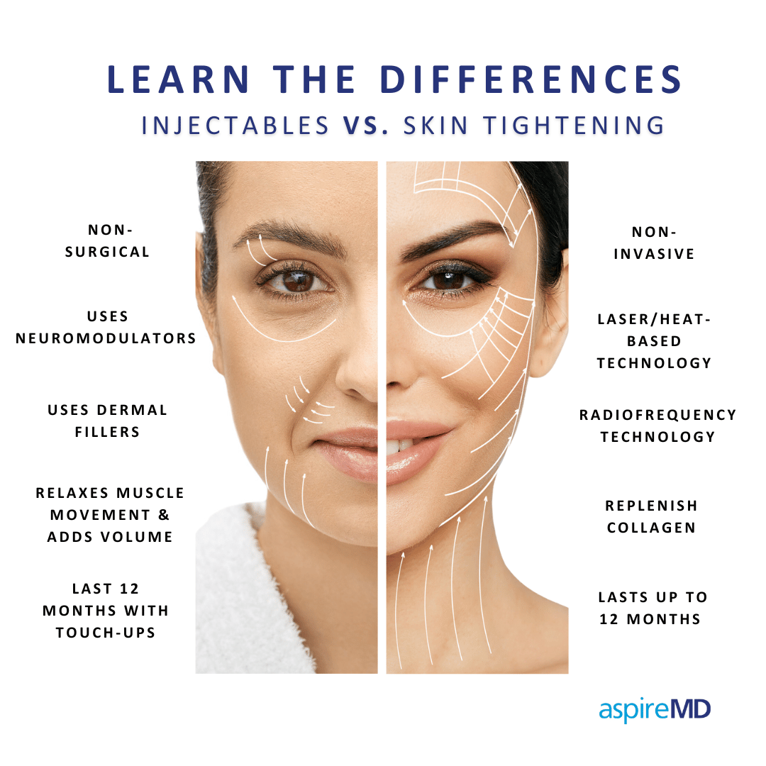 AspireMD-SkinTighteningVs.Softlift featured image