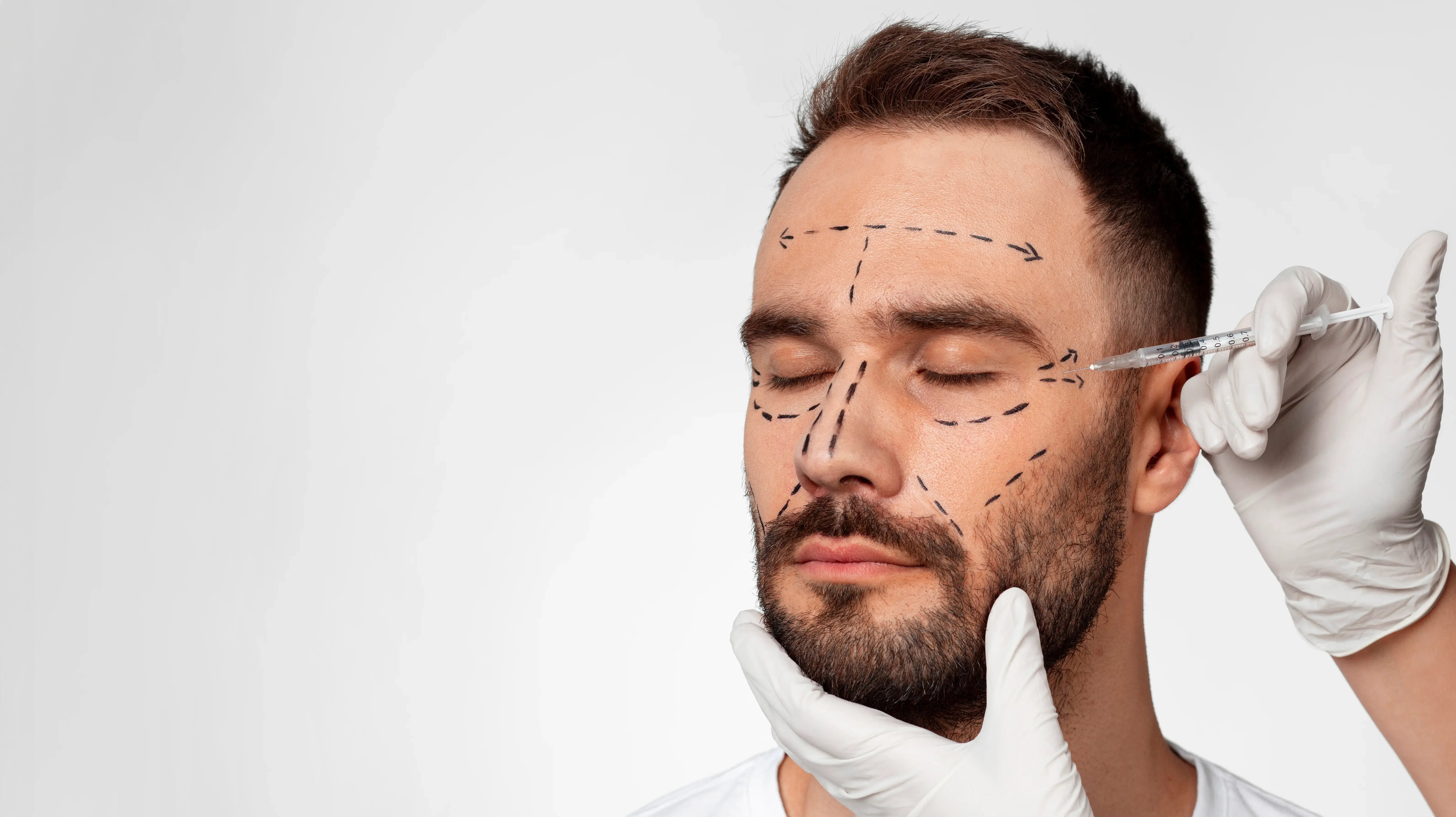Botox for men face placement mapping