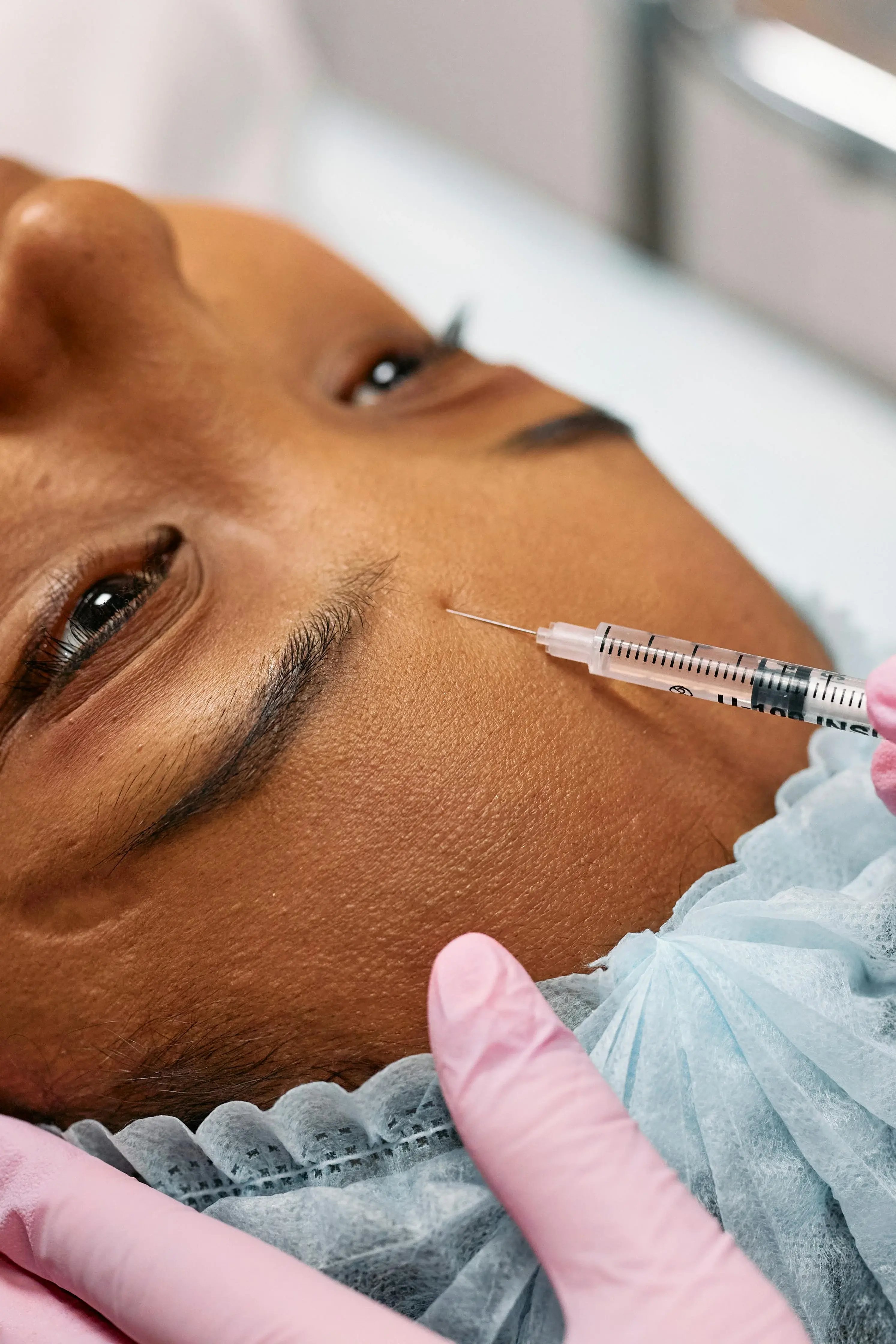 Botox for migraines