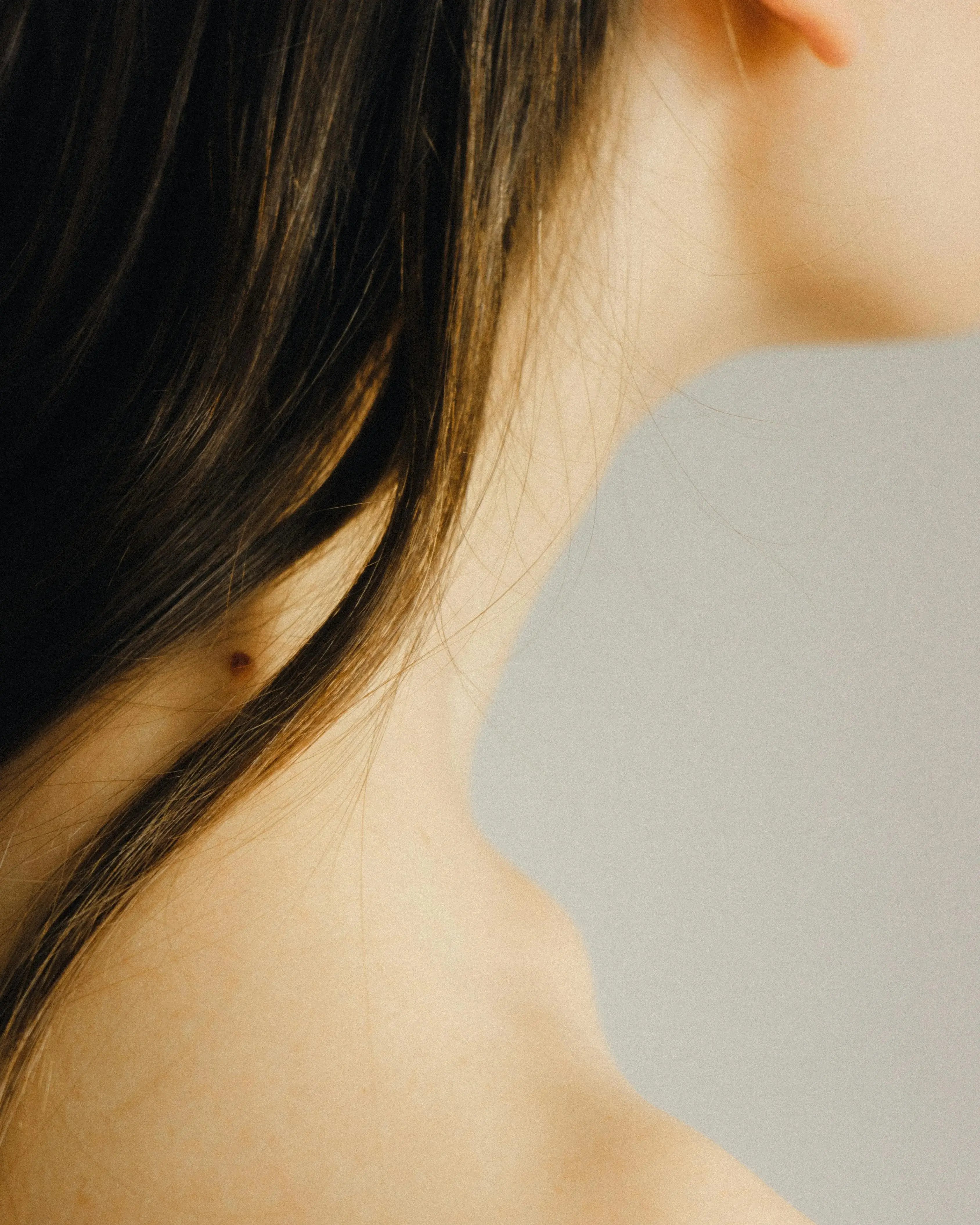 Mole growth on back of  womens neck