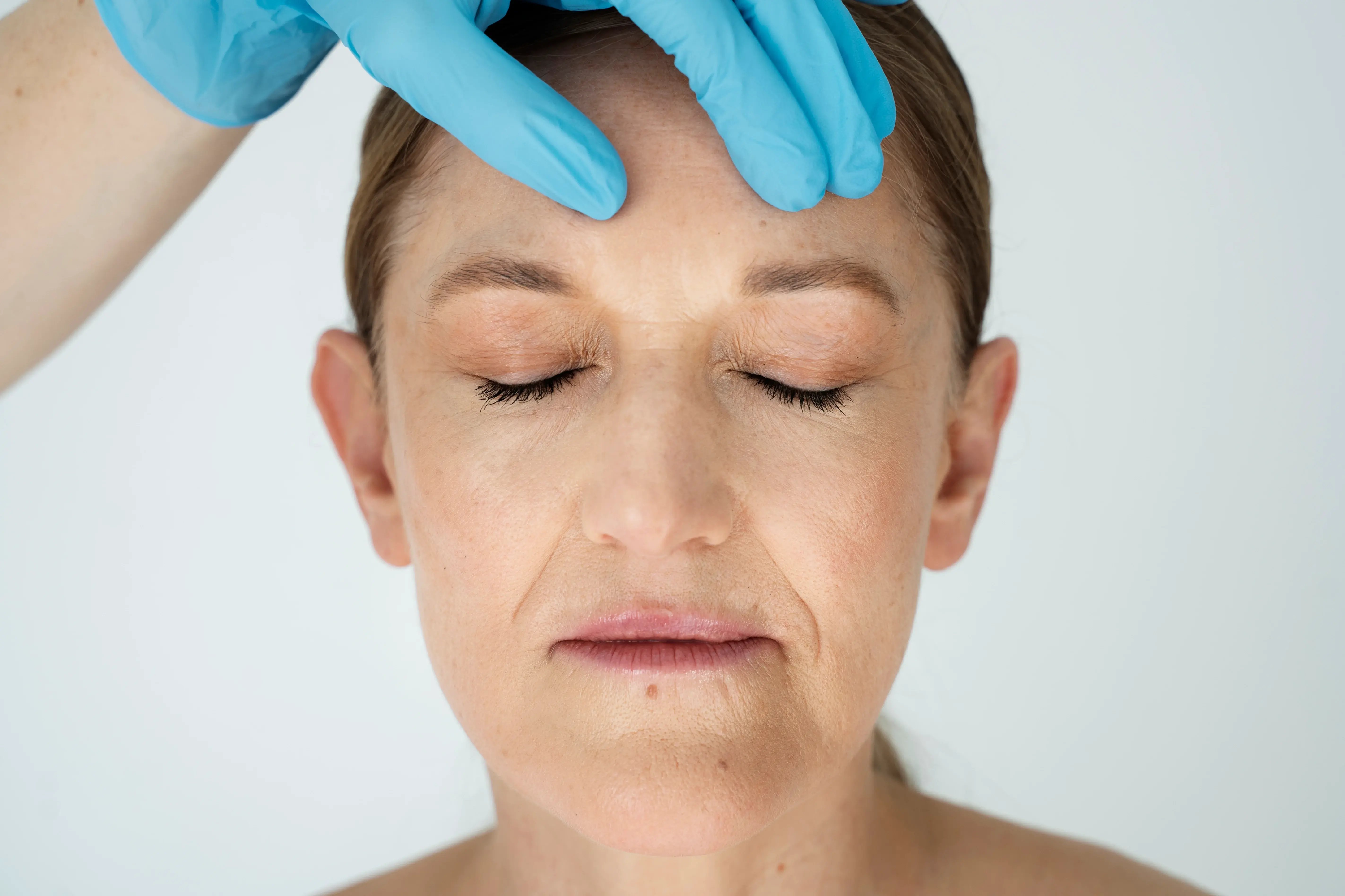 Older women receiving filler for wrinkles