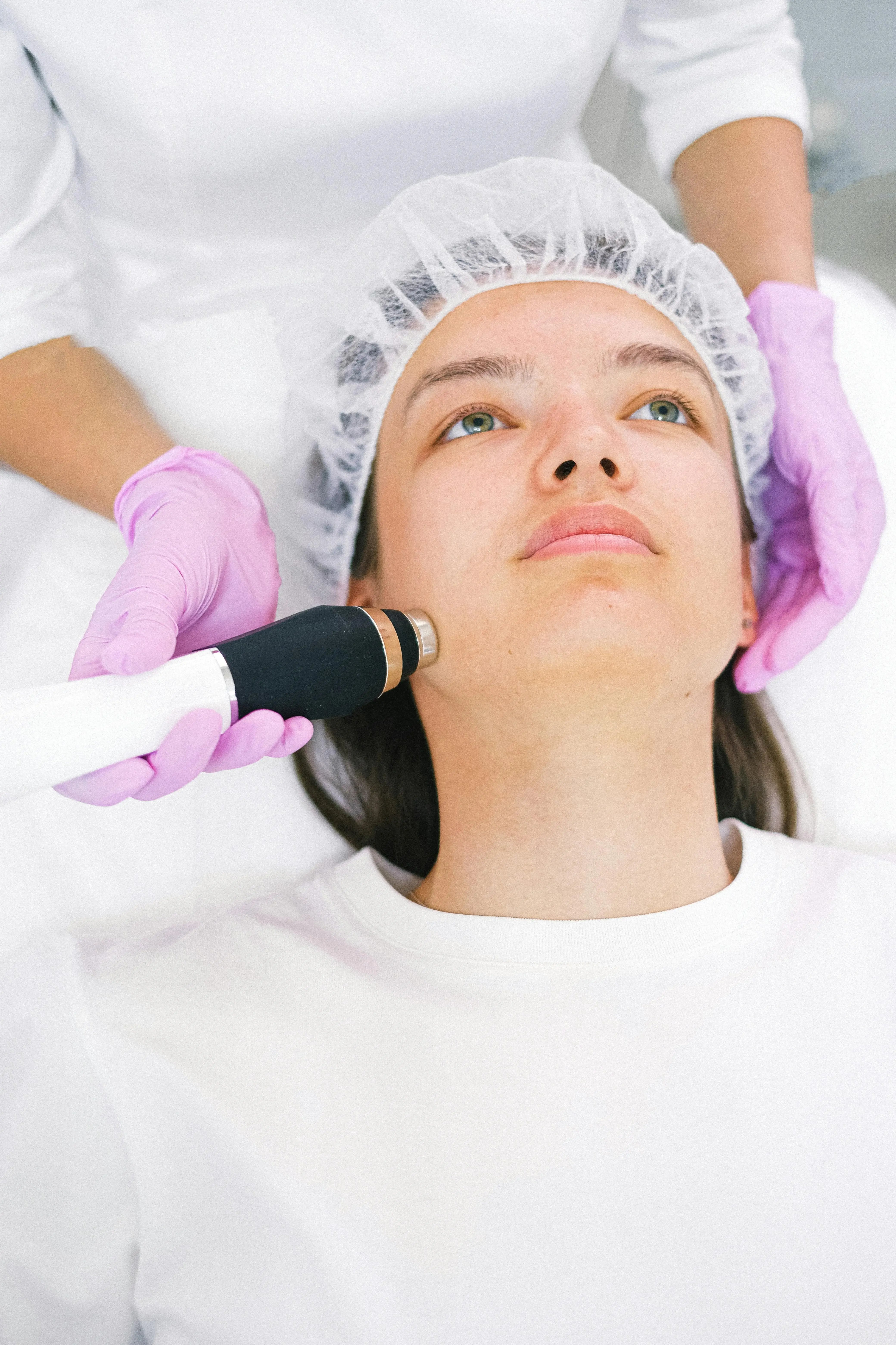 Women getting a microneedling procedure done on her full face