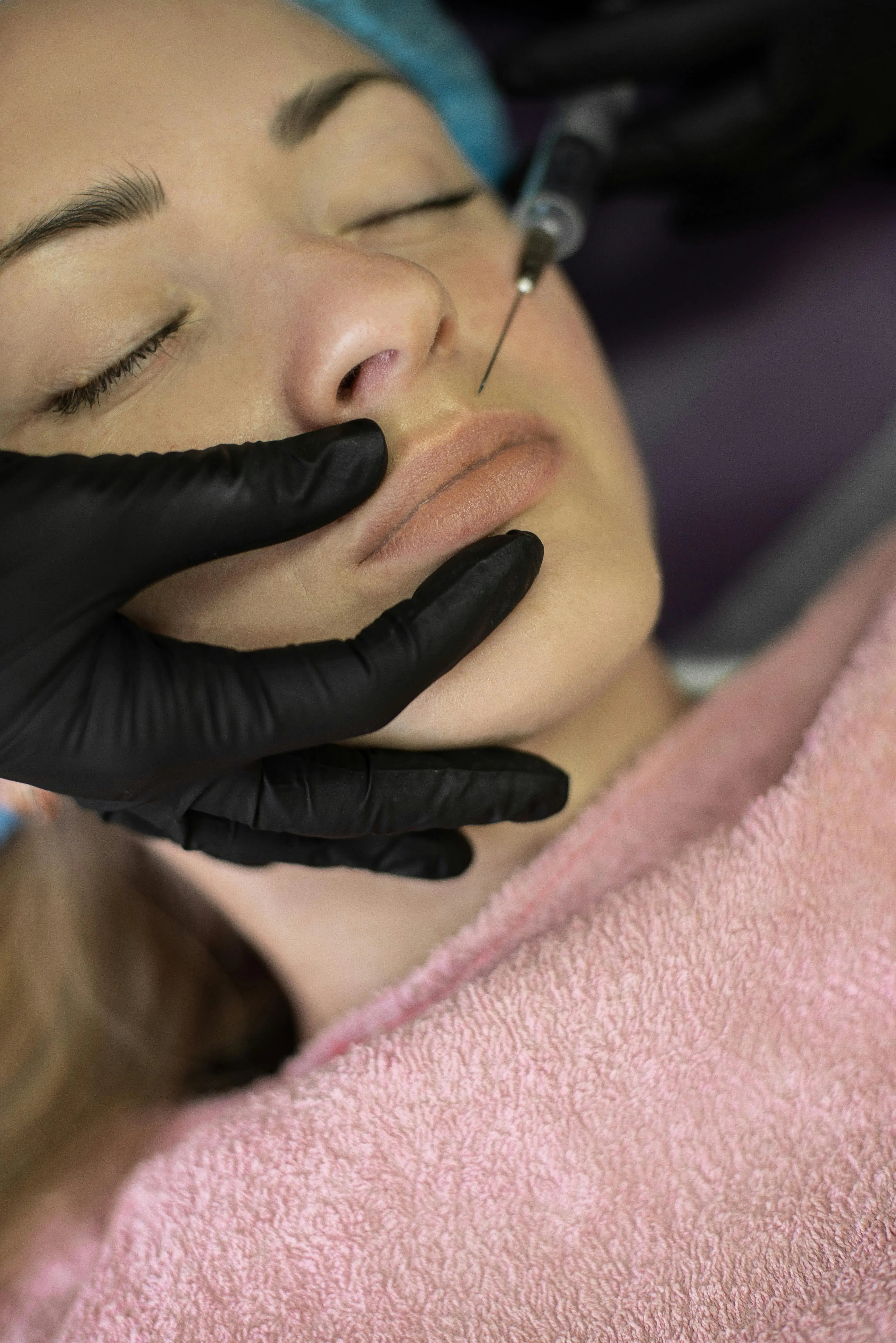close up of women getting lip filler