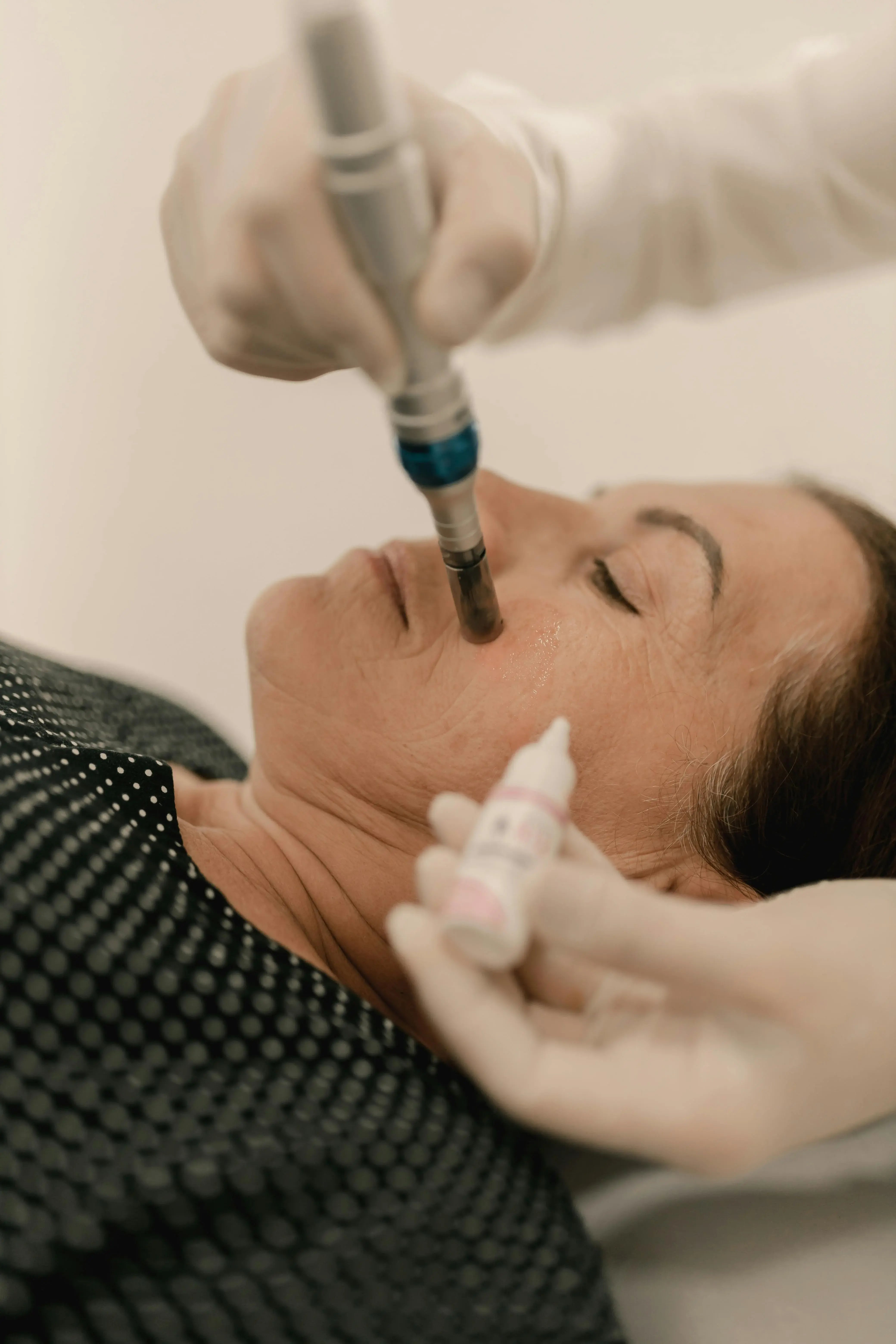 closeup of aesthetician conducting microneedling treatment