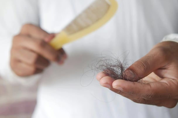 man holding hair in hand from hair loss