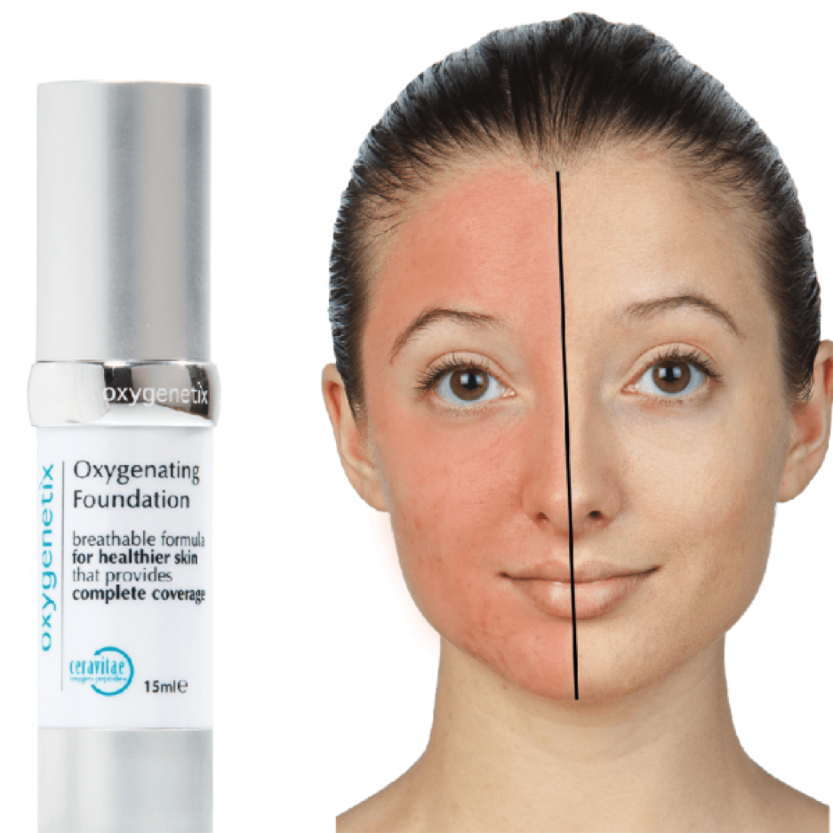 oxygenetix oxygenetix