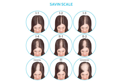 Savin Scale