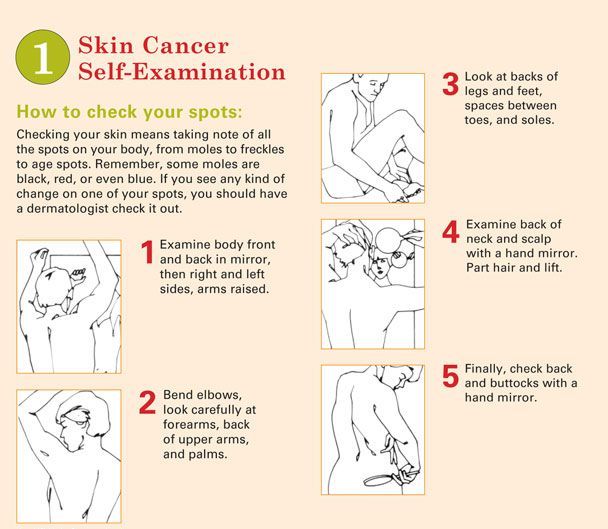 Skin Cancer Self Examination